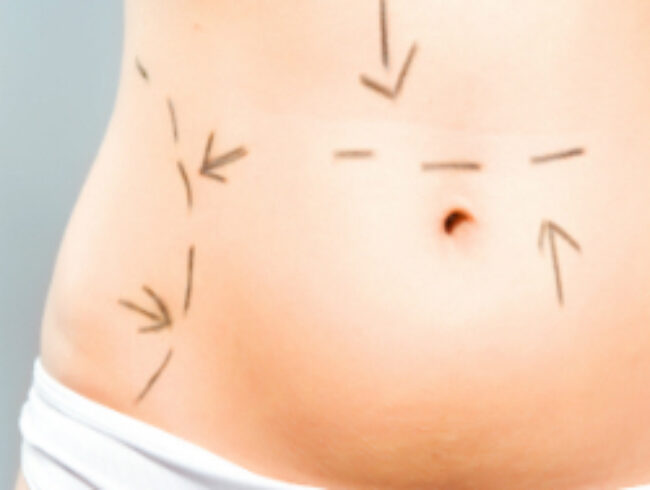 Vrai ou faux : vous devez avoir un poids inférieur à la norme pour recevoir un diagnostic de trouble alimentaire.